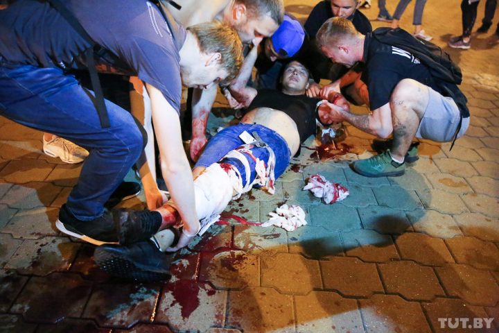 pushkinskaja_20200810_bur_013_75a79244-a9a2-469a-bbd1-8d58719ec5a3 (1)